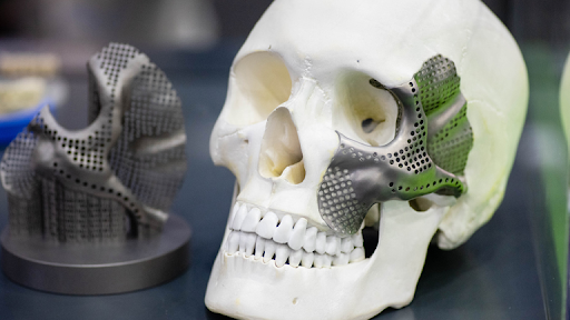 Additive Manufacturing Innovations in Medical Device Development